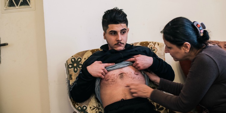 Woman looking at her son's scars on his stomach.