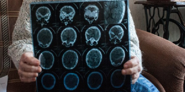 Elderly Jewish woman holding up X-ray scans of her brain.