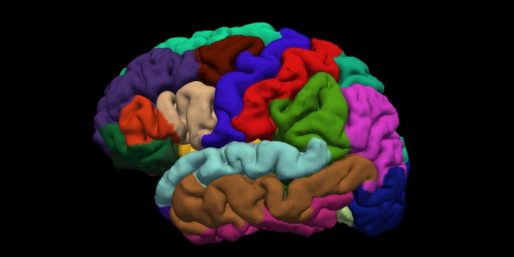 image of Brain MRI, showing how Israeli innovators might have discovered a way to detect Alzheimer’s or Parkinson’s diseases